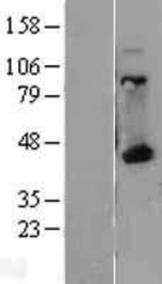 Western Blot: HLA A Overexpression Lysate [NBL1-11581]