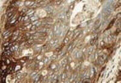 Immunohistochemistry-Frozen: HLA ABC Antibody (W6/32) - Azide and BSA Free [NB100-64775]