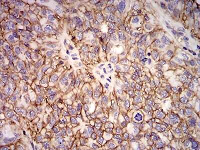 Immunohistochemistry-Paraffin: HLA B Antibody (2A11G7) - BSA Free [NBP2-61872]