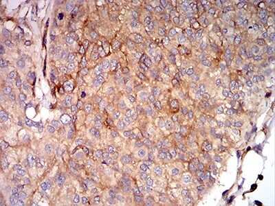 Immunohistochemistry-Paraffin: HLA B Antibody (2A11G7) - BSA Free [NBP2-61872]