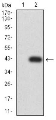 Western Blot: HLA B Antibody (2A11G7)BSA Free [NBP2-61872]