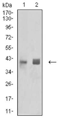 Western Blot: HLA B Antibody (2A11G7)BSA Free [NBP2-61872]