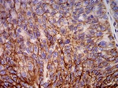 Immunohistochemistry-Paraffin: HLA B Antibody (2G7B10) - BSA Free [NBP2-61871]