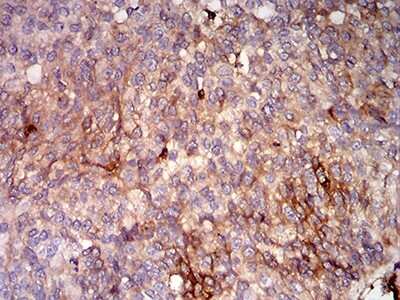Immunohistochemistry-Paraffin: HLA B Antibody (2G7B10) - BSA Free [NBP2-61871]
