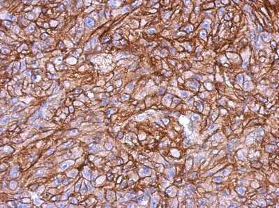 Immunohistochemistry-Paraffin: HLA B Antibody [NBP2-14983]