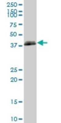 Western Blot: HLA B Antibody [H00003106-B01P]