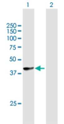 Western Blot: HLA B Antibody [H00003106-B01P]