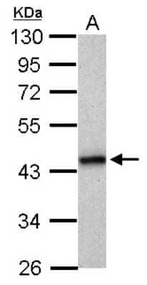 Western Blot: HLA B Antibody [NBP2-14983]