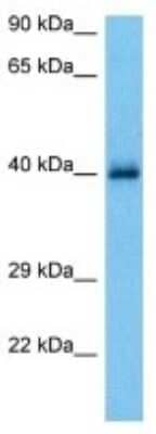 Western Blot: HLA B Antibody [NBP3-10095]