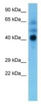 Western Blot: HLA B Antibody [NBP3-10096]