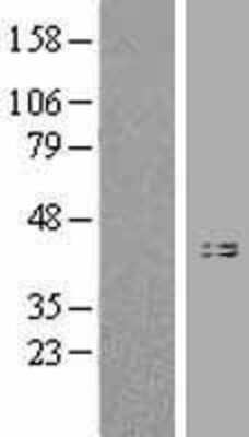 Western Blot: HLA B Overexpression Lysate [NBL1-11585]