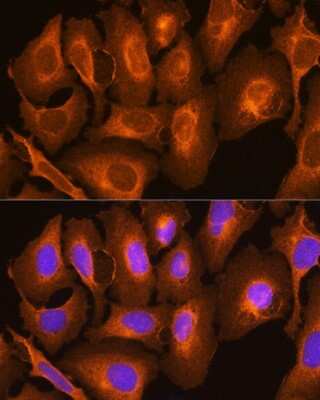 Immunocytochemistry/ Immunofluorescence: HLA C Antibody - BSA Free [NBP3-03848]