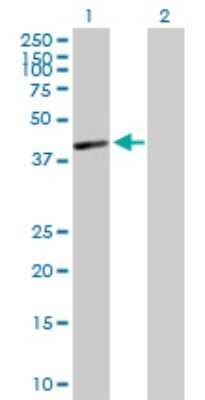 Western Blot: HLA C Antibody [H00003107-B01P]