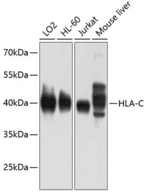 Western Blot: HLA C AntibodyBSA Free [NBP3-03848]