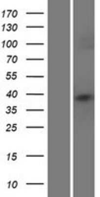 Western Blot: HLA C Overexpression Lysate [NBL1-11594]