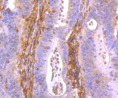 Immunohistochemistry-Paraffin: HLA Class I Antibody [NBP2-75928]