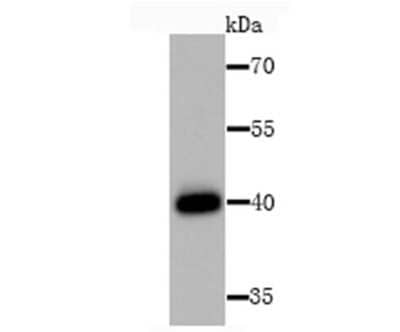 Western Blot: HLA Class I Antibody [NBP2-75928]