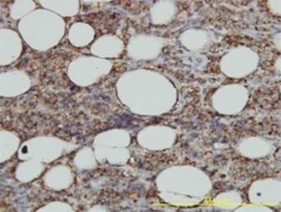 Immunohistochemistry-Paraffin: HLA DMA Antibody (3F12-F11) [H00003108-M01]