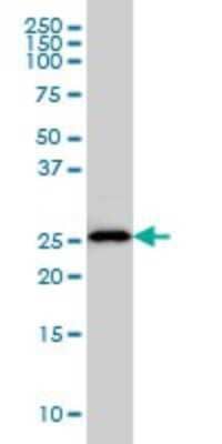 Western Blot: HLA DMA Antibody (3F12-F11) [H00003108-M01]