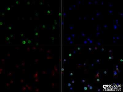 Immunocytochemistry/ Immunofluorescence: HLA DMA Antibody (5C9NB) - Azide Free [NBP2-44301]