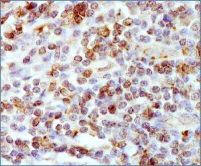Immunohistochemistry: HLA DMA Antibody (5C9NB) - BSA Free [NBP2-44300]
