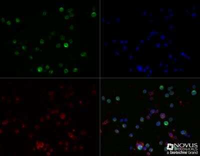 Immunocytochemistry/ Immunofluorescence: HLA DMA Antibody (6B12NB) - Azide Free [NBP2-44304]