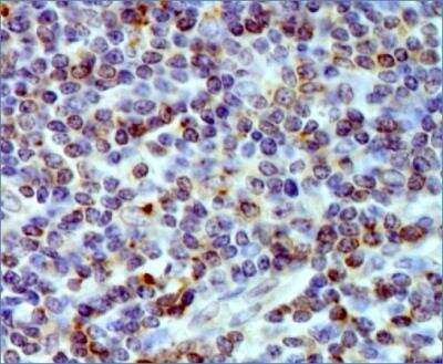 Immunohistochemistry-Paraffin: HLA DMA Antibody (6B12NB) - BSA Free [NBP2-44302]