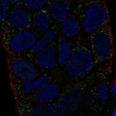 Immunocytochemistry/ Immunofluorescence: HLA DMA Antibody [NBP2-55086]