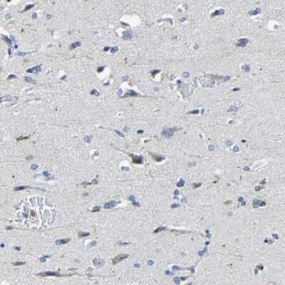 Immunohistochemistry-Paraffin: HLA DMA Antibody [NBP1-85325]