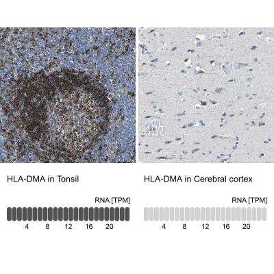 Immunohistochemistry-Paraffin: HLA DMA Antibody [NBP1-85325]
