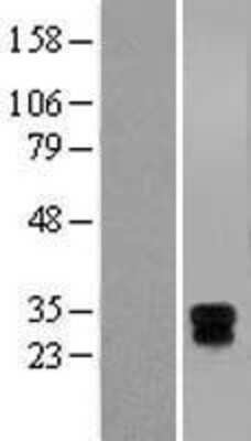 Western Blot: HLA DMA Overexpression Lysate [NBL1-11591]