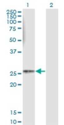 Western Blot: HLA DMB Antibody (4D12) [H00003109-M08]