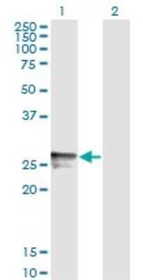 Western Blot: HLA DMB Antibody (7D11) [H00003109-M07]