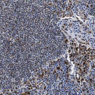 Immunohistochemistry-Paraffin: HLA DMB Antibody [NBP1-85326]