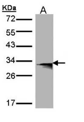 Western Blot: HLA DMB Antibody [NBP1-31138]