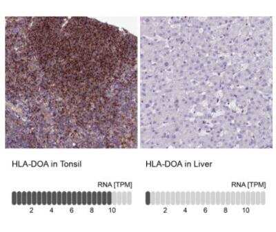 Immunohistochemistry-Paraffin: HLA DOA Antibody [NBP1-91993]