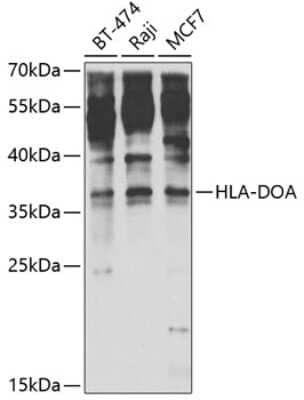 Western Blot: HLA DOA AntibodyBSA Free [NBP3-03621]