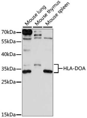 Western Blot: HLA DOA AntibodyAzide and BSA Free [NBP3-03624]