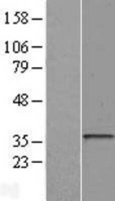 Western Blot: HLA DOA Overexpression Lysate [NBL1-11596]