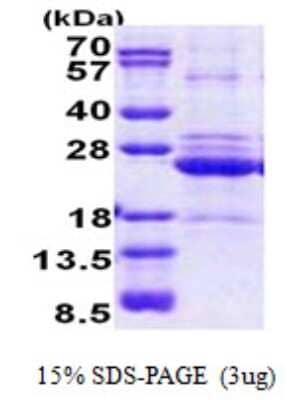 SDS-PAGE: Recombinant Human HLA DOA His Protein [NBP2-23211]