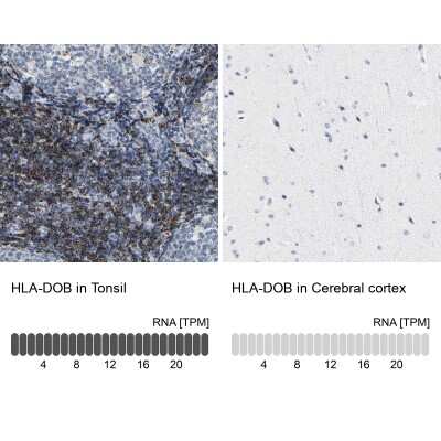 Immunohistochemistry-Paraffin: HLA DOB Antibody [NBP1-87469]