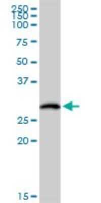 Western Blot: HLA DOB Antibody [H00003112-D01P]