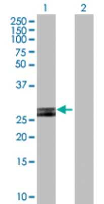 Western Blot: HLA DOB Antibody [H00003112-D01P]