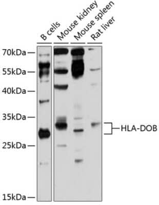 Western Blot: HLA DOB AntibodyAzide and BSA Free [NBP3-03628]