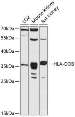 Western Blot: HLA DOB AntibodyAzide and BSA Free [NBP3-03629]