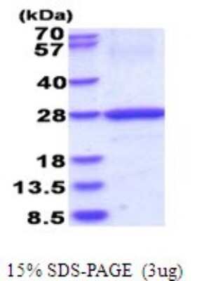 SDS-PAGE: Recombinant Human HLA DOB His Protein [NBP2-51696]