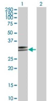 Western Blot: HLA DPA Antibody (1E3) [H00003113-M03]