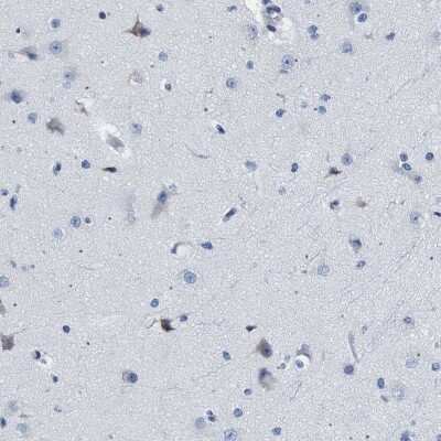 Immunohistochemistry-Paraffin: HLA DPA Antibody [NBP1-89689]