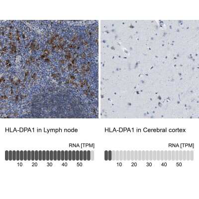 Immunohistochemistry-Paraffin: HLA DPA Antibody [NBP1-89689]