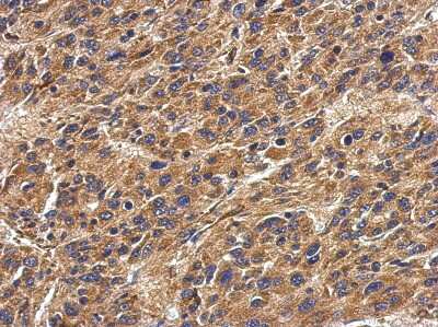 Immunohistochemistry-Paraffin: HLA DPA Antibody [NBP2-16851]